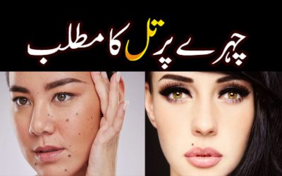 Mole Meaning On Face