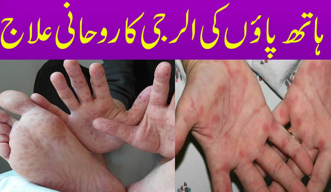 Allergy (Kharish) se Hifazat Ka Rohani Ilaj