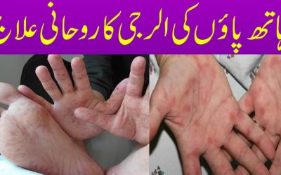 Hath Paon Ki Allergy Aur Kharish Ka Rohani Ilaj