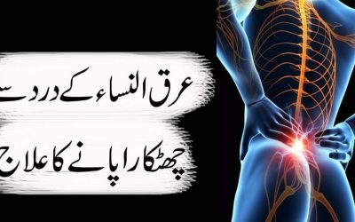 Sciatica/Arq Un Nisa K Dard Ka Ilaj