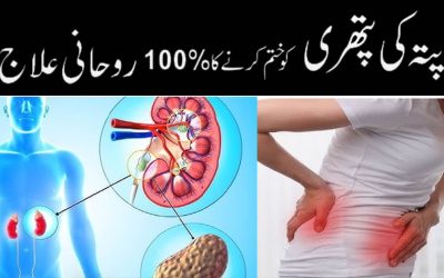 Pitay Ki Pathri Ko Khatam Karne Ka Rohani Ilaj