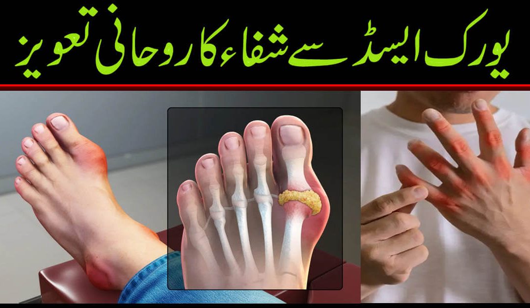 Uric Acid Bimari Ka Rohani Ilaj