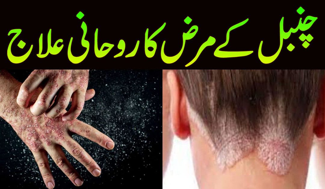 Chambal Ke Marz Ka Rohani Ilaj