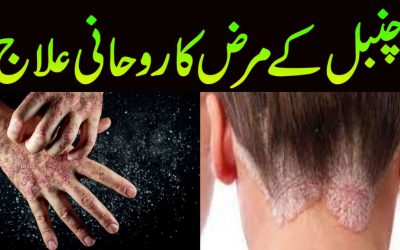 Chambal Ke Marz Ka Rohani Ilaj