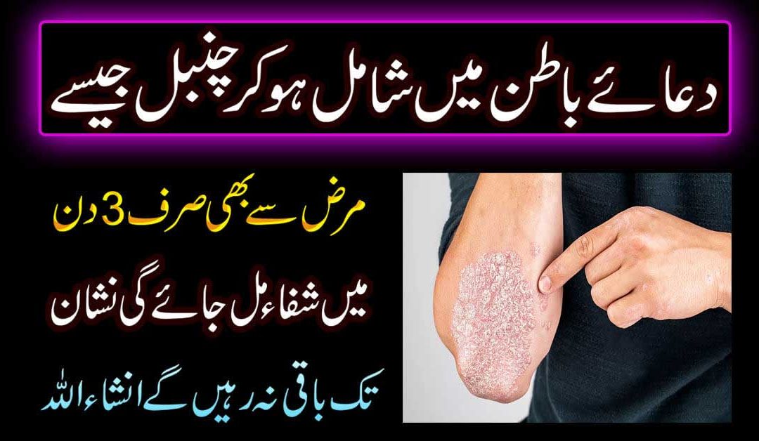 Chambal Jaise Marz Se Nijat Ki Dua