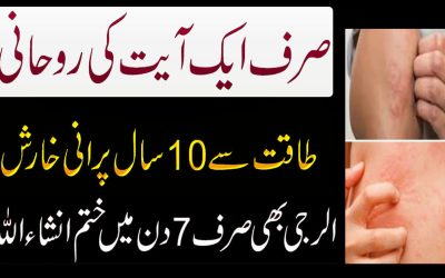 Purani Kharish Ka Rohani Ilaj | Naqsh For Itchy Skin