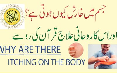 Jism Par Kharish Kyu Hoti Hai | Kharish Khatam Karne Ka Naqsh