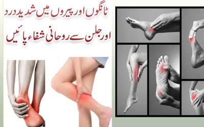 Leg And Foot Pain Treatment | Tangon Or Paon K Dard Ka Ilaj