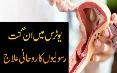 Fibroids Treatment Without Surgery