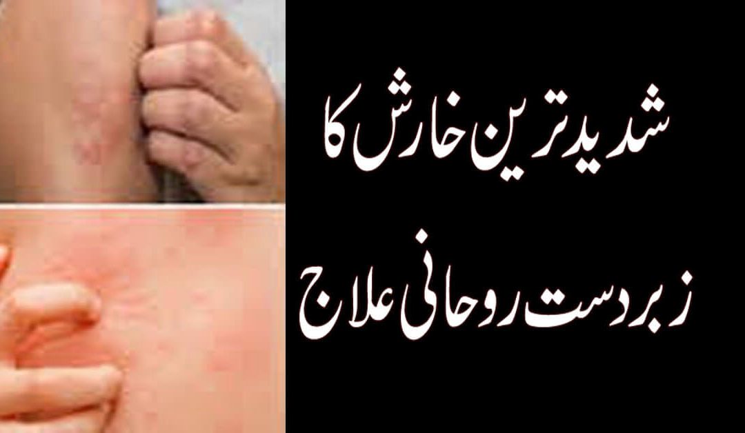 Itching Disease In Urdu