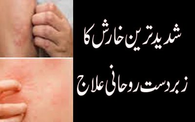 Itching Disease | Taweez For Itching Problem