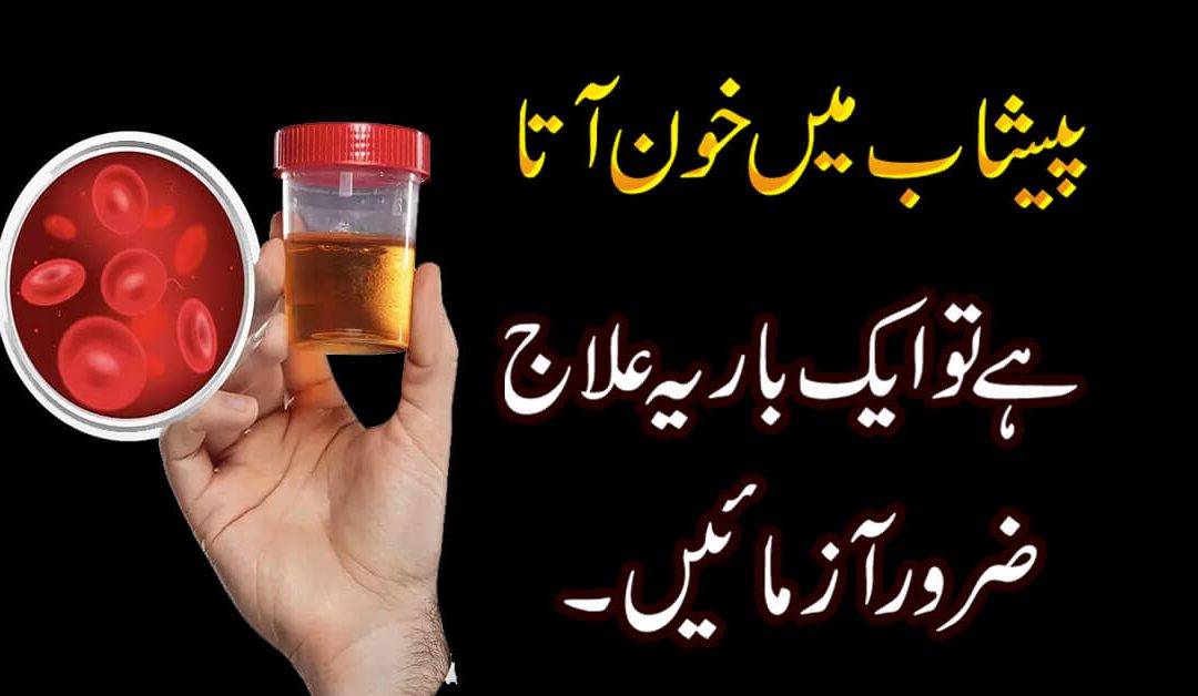 Hematuria Ka Rohani Ilaj