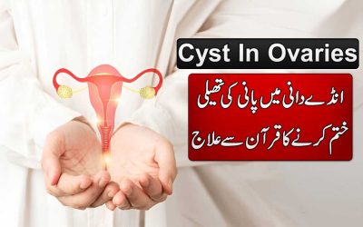 Cyst Se Shifa Ka Rohani Naqsh