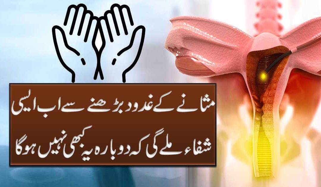 Prostate Glands Treatment In Urdu