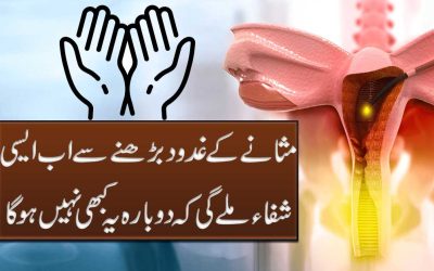 Prostate Glands Treatment In Urdu
