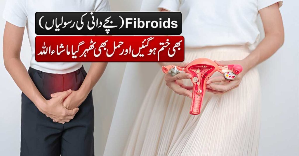 Fibroids Khatam Ho Gaya Aur Hamal Thehar Gaya