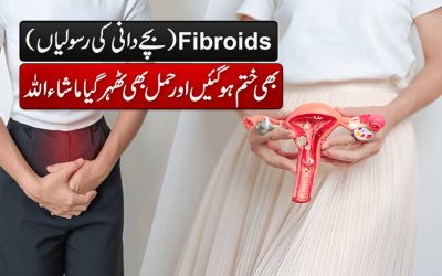 Fibroids Ko Khatam Karne Ka Naqsh