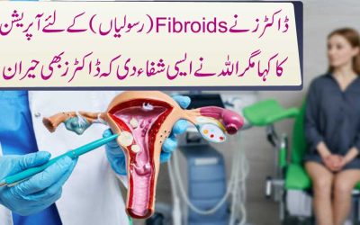 Fibroid Treatment Without Surgery
