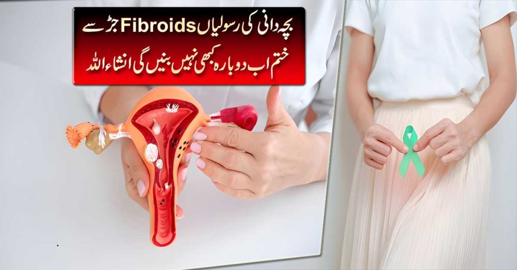 Fibroids Ka Quran Mein Ilaj