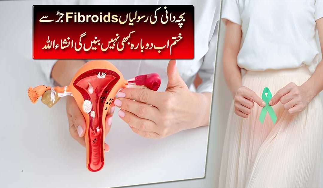 Fibroids Ka Quran Mein Ilaj