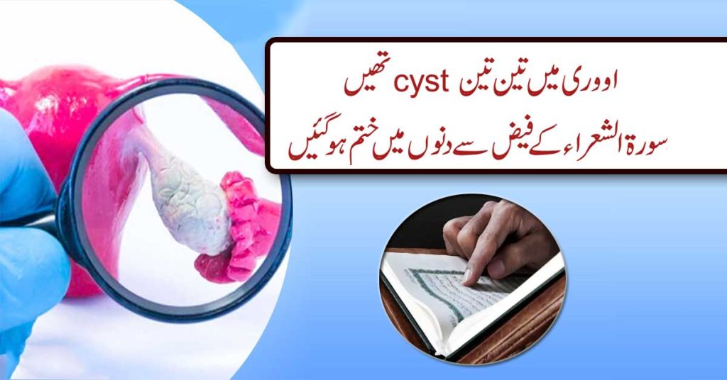 Cyst Pani Ki Theliyan Khatam Surah Shuara K Naqsh Se