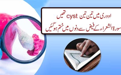 Cyst Se Shifa Ka Naqsh