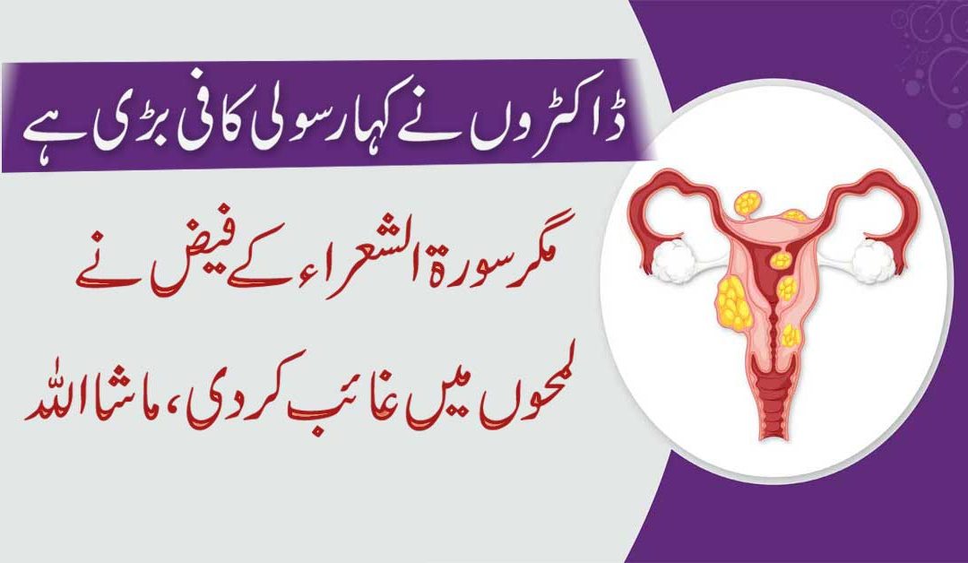 Surah Shuara K Powerful Naqsh Se Rasoli Bagair Operation Ke Hi Khatam