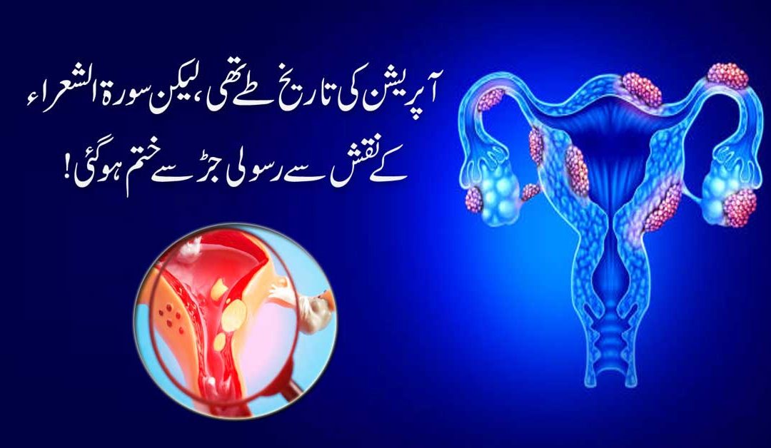 Bachaydani Ki Rasolian Khatam Karne Ka Taweez