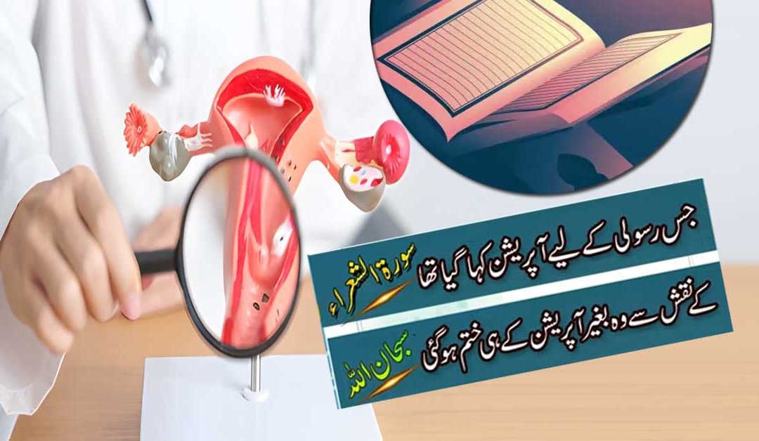 Surah Shuara K Naqsh Se Rasoli Bagair Operation Ke Hi Khatam