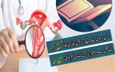Fibroid Se Shifa Ka Naqsh