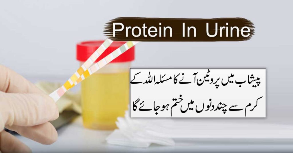Peshab Mein Protein Aana Ka Rohani Ilaj