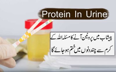 Protein In Urine Treatment In Quran
