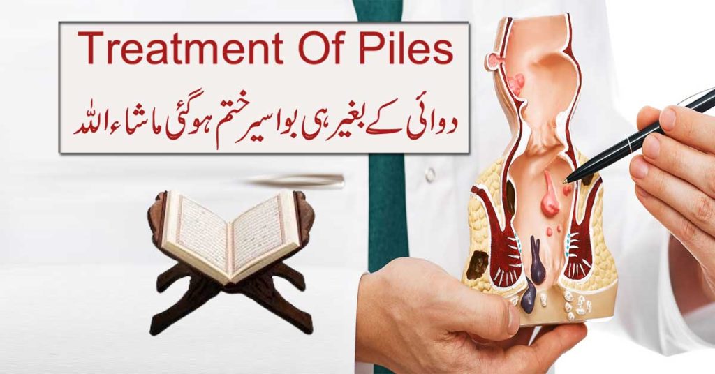 Bawaseer (Piles) Ke Marz Se Shifa