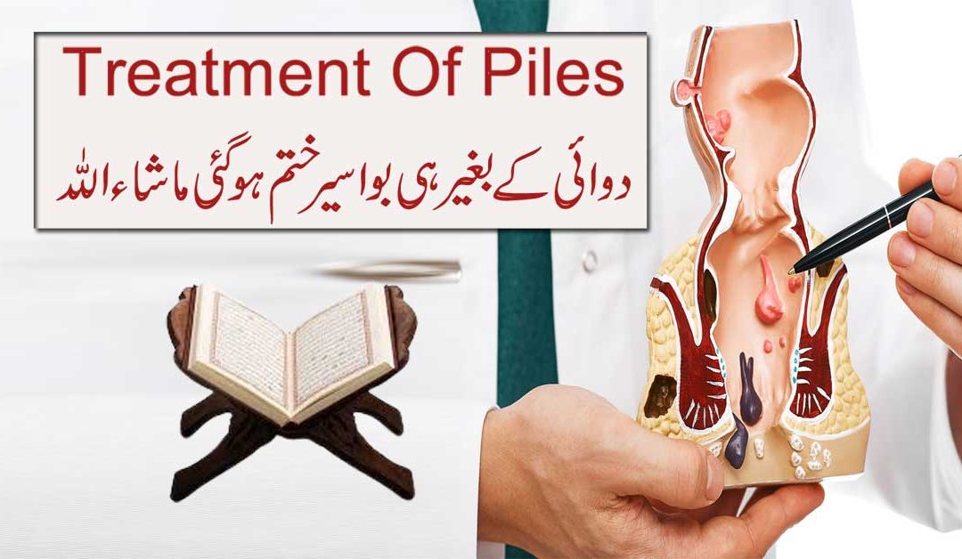 Bawaseer (Piles) Ke Marz Se Shifa