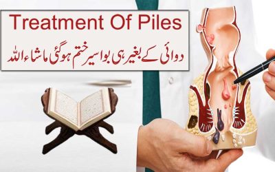 Salon Purani Bawaseer Ka Ilaj