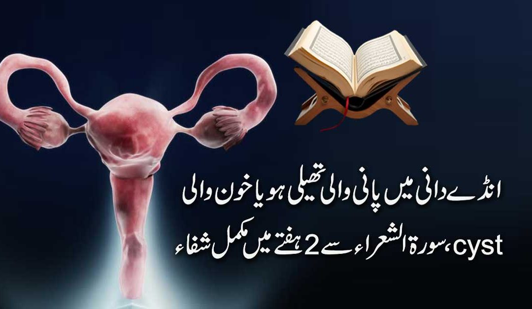 Ovarian Cyst Ka Rohani Ilaj